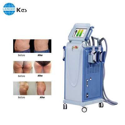 Máquina de perda de peso de redução de gordura por criolipólise de congelamento de gordura/Máquina de criolipólise de congelamento de gordura eficaz