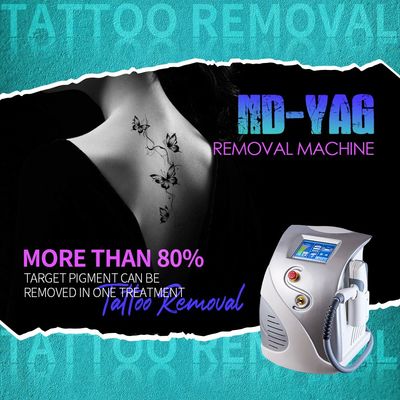 Máquina de remoção de tatuagens a laser de alta potência Q Switch ND YAG